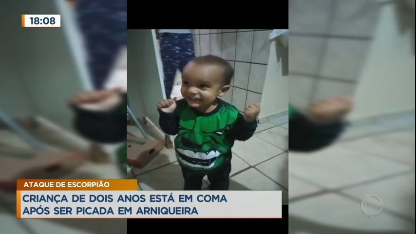 Vídeo: Criança de 2 anos está em estado grave após picada de escorpião
