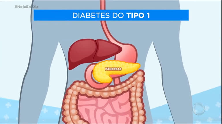 Vídeo: Doutor Visita : Conheça os sintomas da diabetes