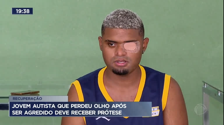 Vídeo: Jovem autista que perdeu olho após ser agredido deve receber prótese