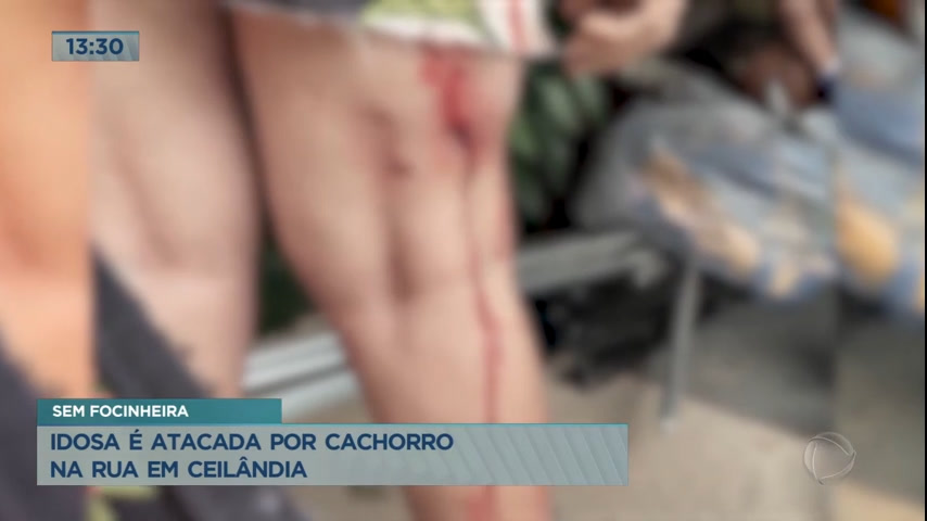 Vídeo: Idosa é atacada por cachorro em Ceilândia (DF)