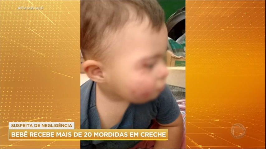 Vídeo: Bebê portador de síndrome de Down recebe mais de 20 mordidas em creche de MG