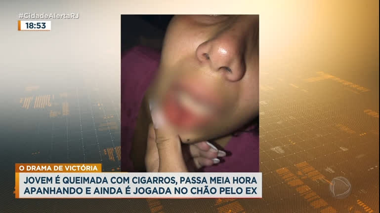 Vídeo: Jovem é queimada com cigarros e agredida durante meia hora pelo ex no RJ