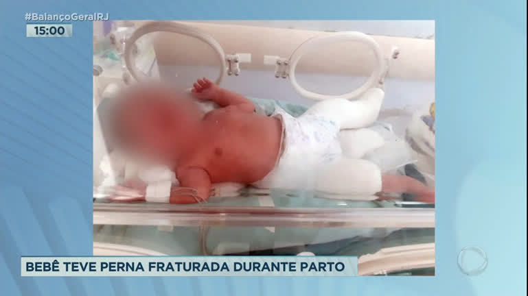Vídeo: Bebê tem perna fraturada durante o parto na zona oeste do Rio