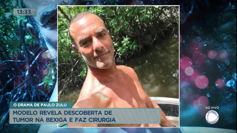 Vídeo: Paulo Zulu revela descoberta de tumor na bexiga e faz cirurgia