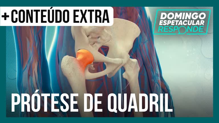 Vídeo: Sergio Mallandro e Zico têm próteses no quadril; saiba como evitar o problema | DE Responde