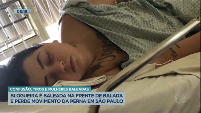 Vídeo: Blogueira é baleada na frente de boate em SP e perde movimento de perna