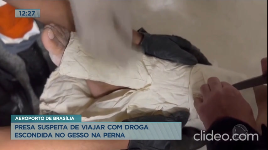 Vídeo: Mulher é presa com 3kg de cocaína escondida em gesso na perna