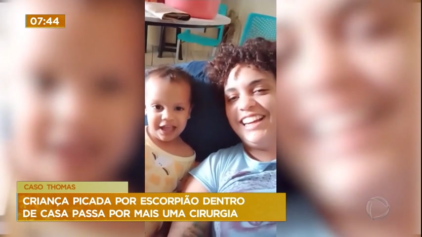 Vídeo: Criança picada por escorpião dentro de casa passa por mais uma cirurgia