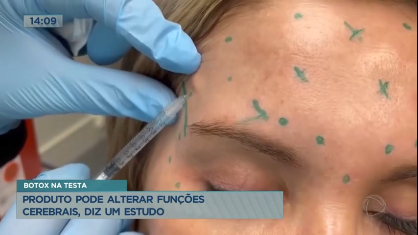 Vídeo: Botox na testa pode alterar funções cerebrais, diz estudo
