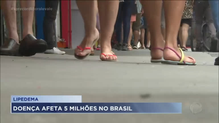 Vídeo: Lipedemia afeta uma em cada dez mulheres no Brasil