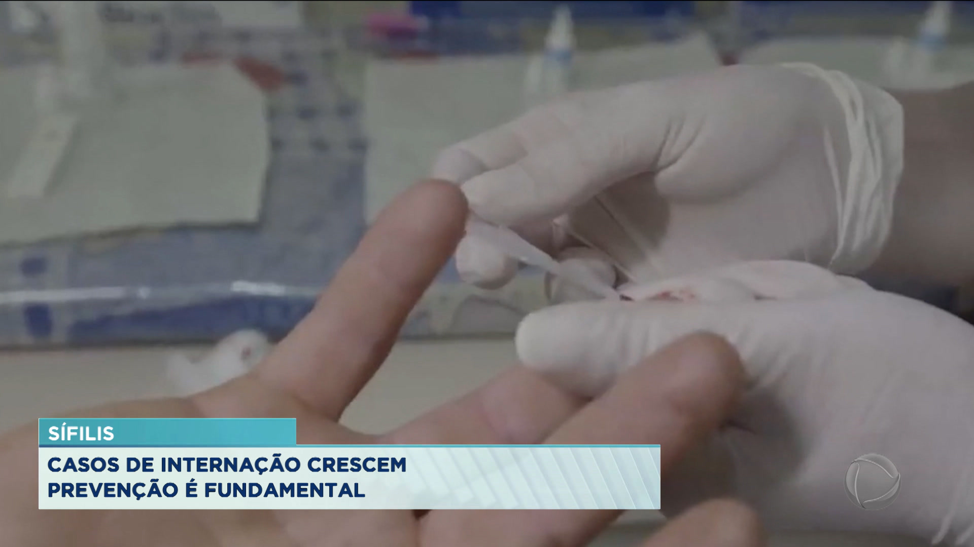 Vídeo: Internação por sífilis aumenta na Baixada Santista