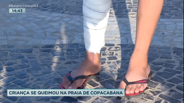 Vídeo: Menino de oito anos tem queimaduras ao cair em buraco com carvão em Copacabana