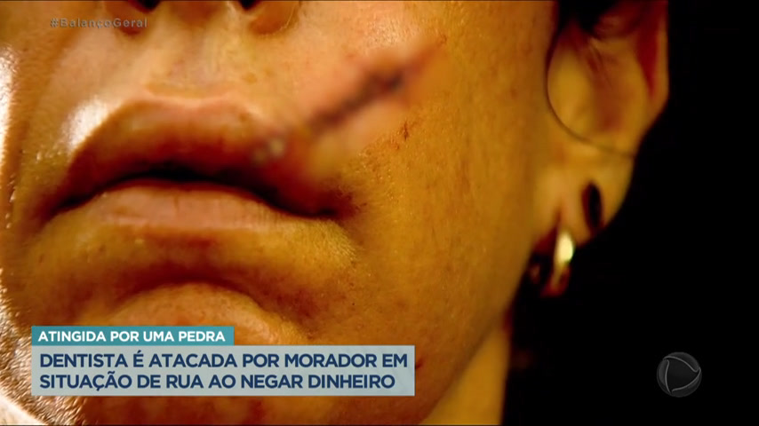 Vídeo: Dentista é agredida por morador de rua em Minas Gerais
