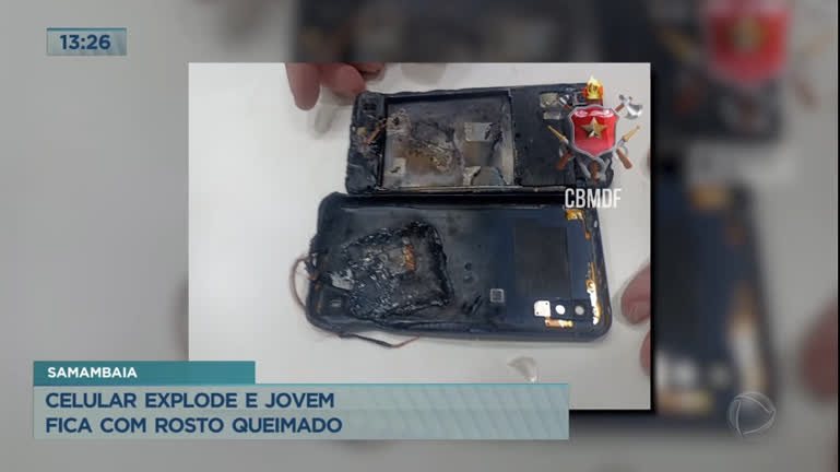 Vídeo: Jovem sofre queimaduras após celular que estava carregando explodir