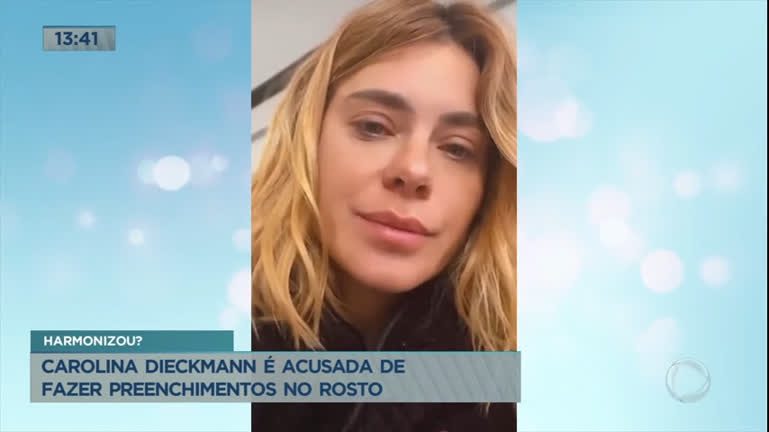 Vídeo: Fãs especulam procedimentos no rosto de Carolina Dieckmann