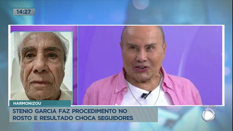 Vídeo: Stênio Garcia faz procedimento no rosto e resultado choca seguidores