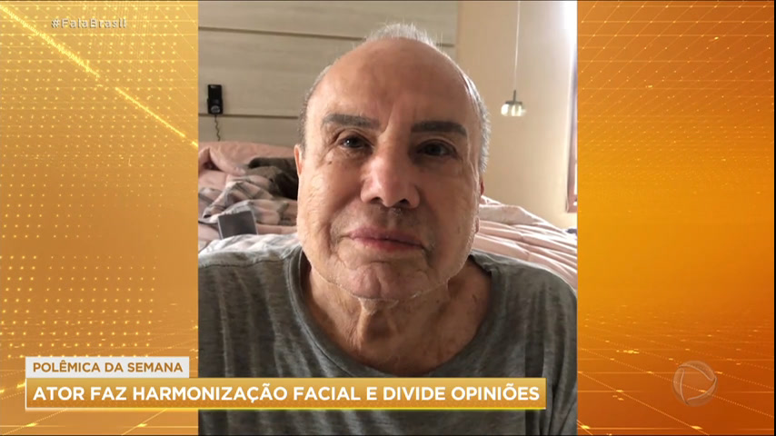 Vídeo: Stênio Garcia faz harmonização facial e é criticado na web