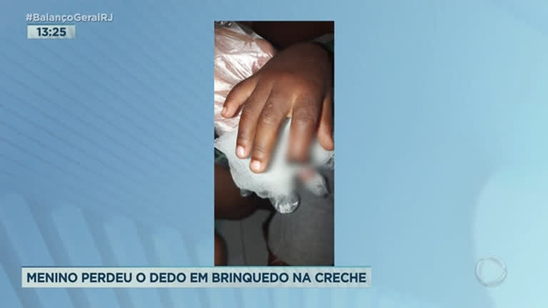 Vídeo: Criança perde parte do dedo em brinquedo de creche no RJ