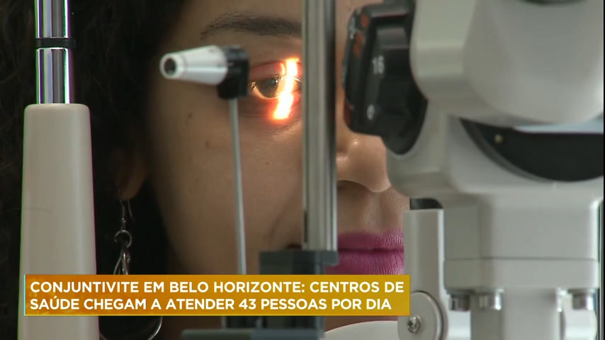 Vídeo: Belo Horizonte registra aumento de casos de conjuntivite nas últimas duas semanas