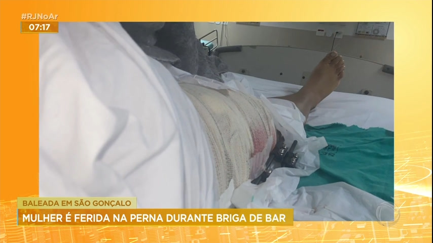 Vídeo: Mulher é baleada na perna durante confusão em São Gonçalo