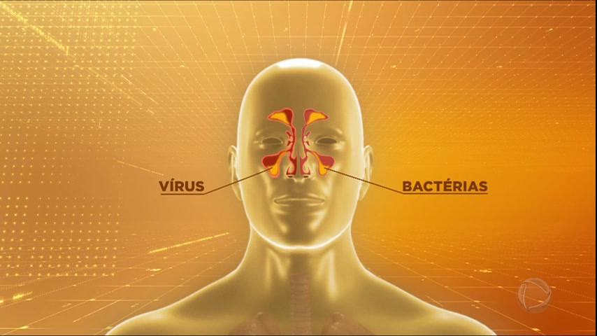 Vídeo: Sinusite bacteriana, que afeta a cantora Joelma, pode chegar ao cérebro e aos olhos