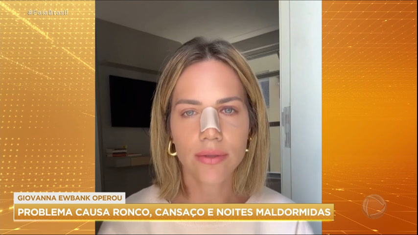 Vídeo: Giovanna Ewbank faz cirurgia no nariz para corrigir desvio de septo