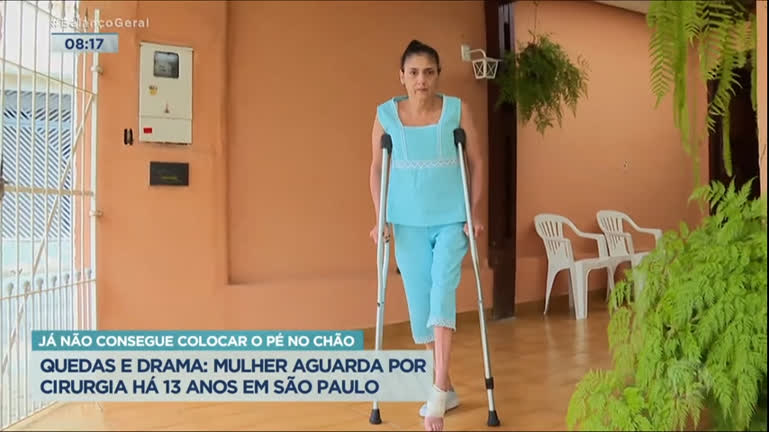 Vídeo: Mulher espera há 13 anos por cirurgia e não consegue colocar pé no chão