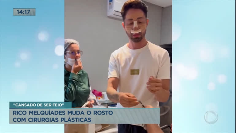 Vídeo: Rico Melquíades muda o rosto com cirurgias plásticas