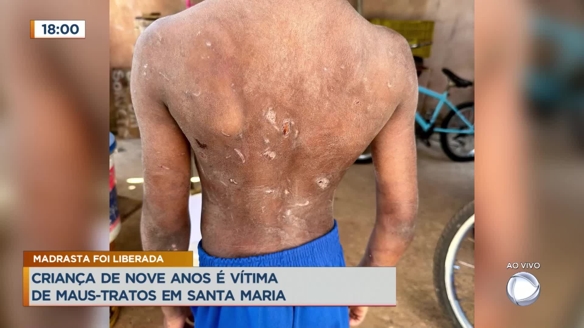 Vídeo: Criança de 9 anos é vítima de maus-tratos em Santa Maria (DF)