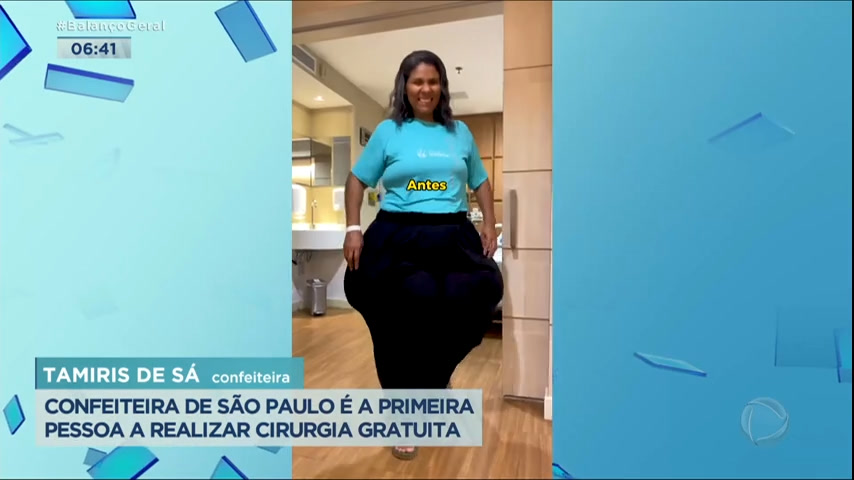 Entenda o que é lipedema, doença que atinge 5 milhões de brasileiras -  SBT News