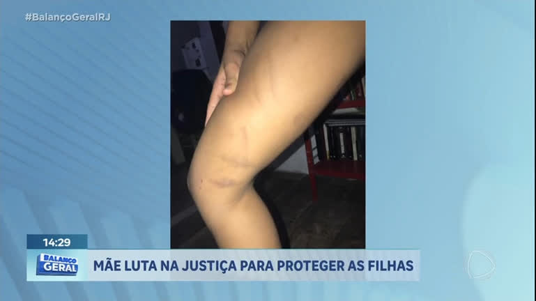 Vídeo: 'Me bateu com chinelo, cinto e cabide', diz menina agredida pelo pai no Rio