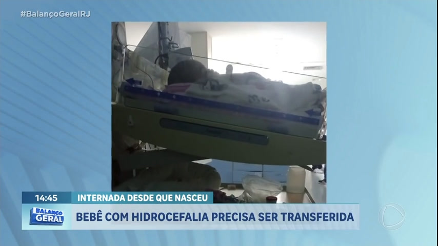 Vídeo: Bebê com hidrocefalia está internada desde que nasceu e aguarda transferência no Rio