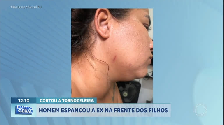 Vídeo: Mulher é espancada pelo ex-marido na frente dos filhos no RJ; homem cortou tornozeleira eletrônica