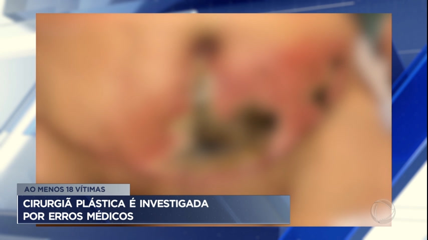 Vídeo: Cirurgiã plástica do DF é investigada por erros médicos e negligência