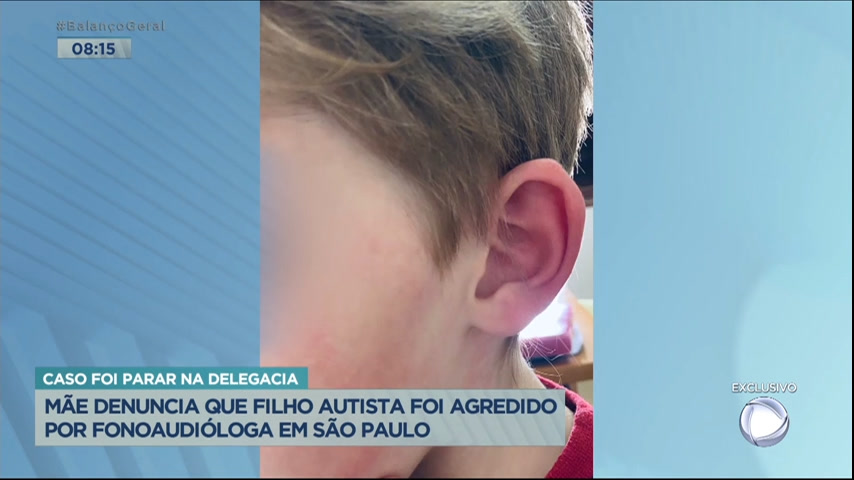 Vídeo: Mãe denuncia que filho autista foi agredido por fonoaudióloga em SP