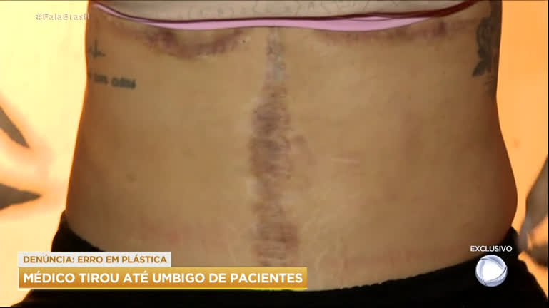 Vídeo: Exclusivo: Pacientes denunciam médico por sequelas após cirurgias plásticas
