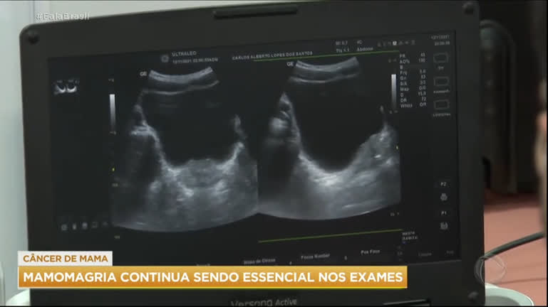 Vídeo: Novo exame de sangue reconhece câncer de mama em fase inicial Vídeo: Novo exame de sangue reconhece câncer de mama em fase inicial