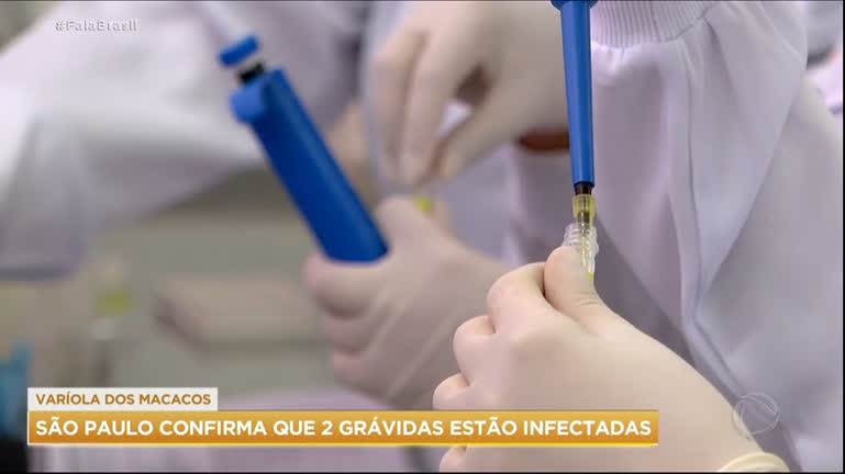 Vídeo: São Paulo confirma primeiros casos de varíola do macaco em grávidas