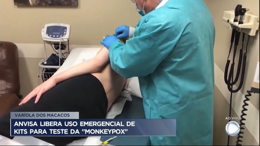 Vídeo: Anvisa libera uso emergencial de kits para testes da varíola do macaco