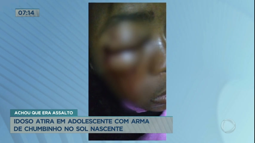Vídeo: Idoso atira em adolescente com arma de chumbinho no Sol Nascente (DF)