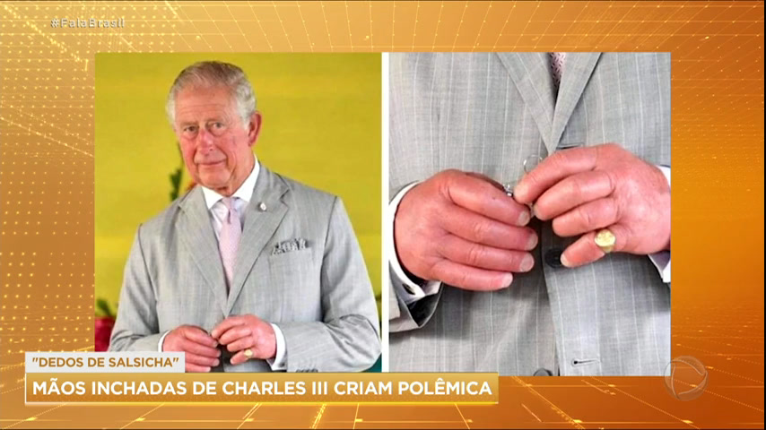 Vídeo: Dedos inchados do rei Charles 3º chamam atenção nas redes sociais