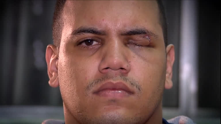 Vídeo: Exclusivo: vídeos mostram agressão policial que deixou motoboy cego de um olho