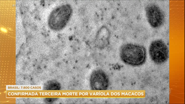 Vídeo: Terceira morte por varíola dos macacos é confirmada no Brasil
