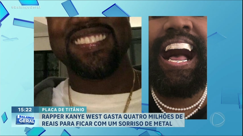 Vídeo: Rapper Kanye West gasta R$ 4 milhões para ficar com sorriso metálico