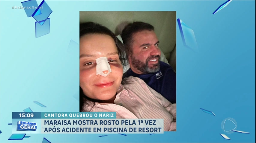 Vídeo: Maraisa mostra nariz quebrado após acidente em piscina de resort