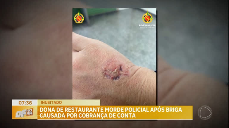 Vídeo: Dona de restaurante em São Sebastião morde policial após briga generalizada