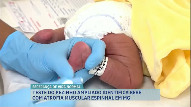 Vídeo: Teste do pezinho identifica primeiro caso de atrofia muscular espinhal em recém-nascida de MG