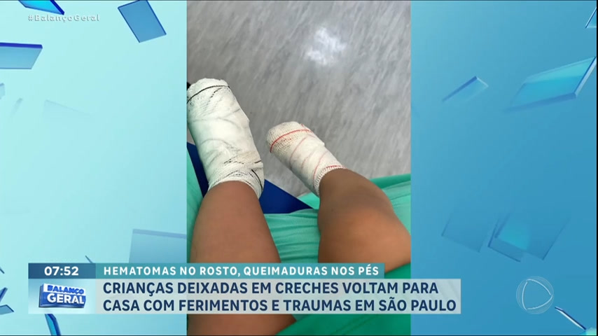Vídeo: Mães denunciam que filhos voltaram de creches de SP com ferimentos