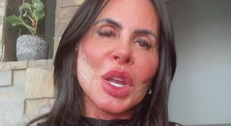 Vídeo: Gretchen faz procedimento estético para deixar o rosto mais fino