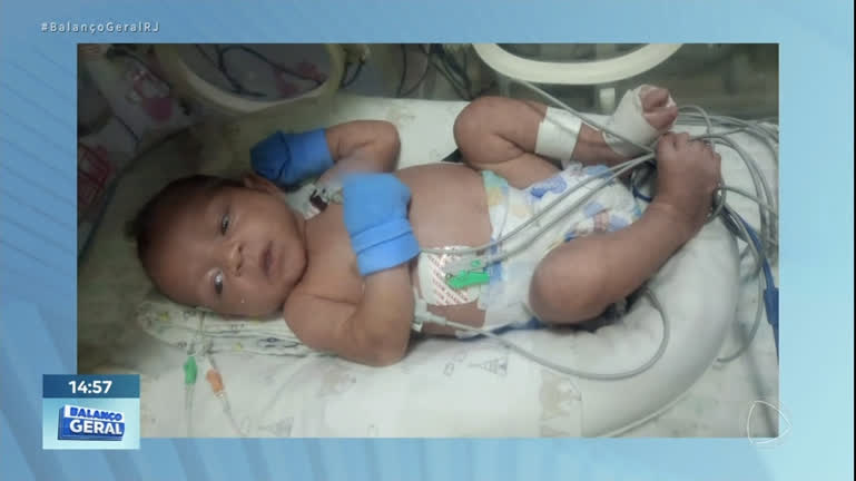Vídeo: Bebê com problema grave nos rins aguarda transferência com urgência em hospital no Rio